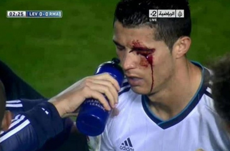 爱游戏团队-莱万特旧将：我过去曾无意肘击C罗，媒体却几乎要把我关进监狱